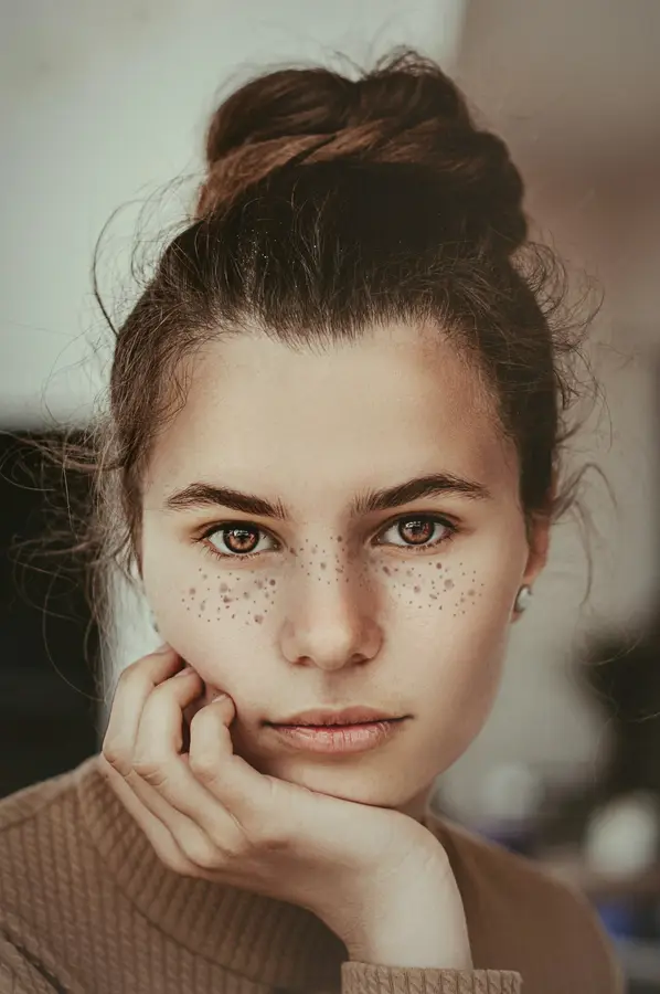 A young woman with freckles resting her chin on her hand